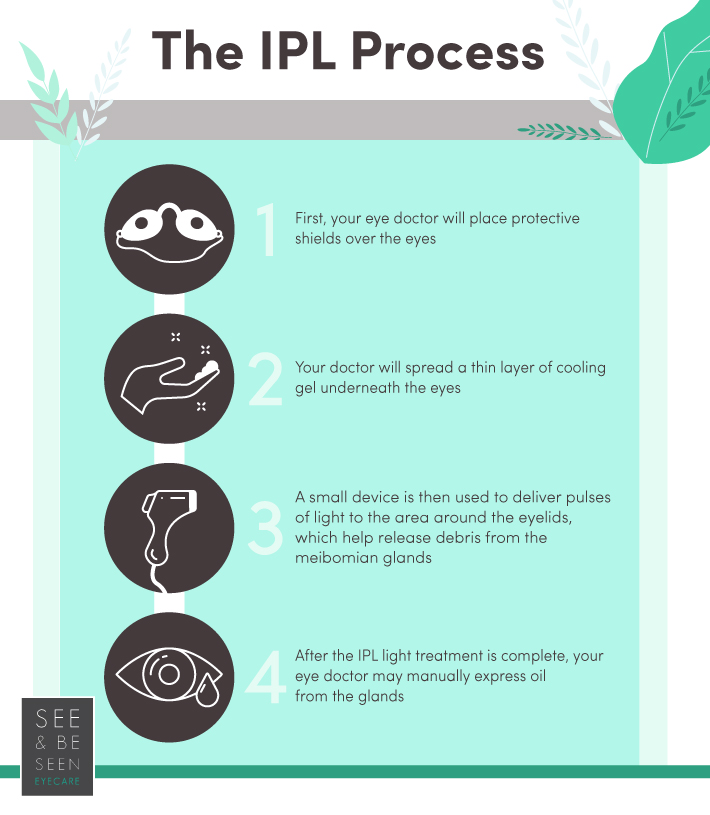 IPL process shown through steps