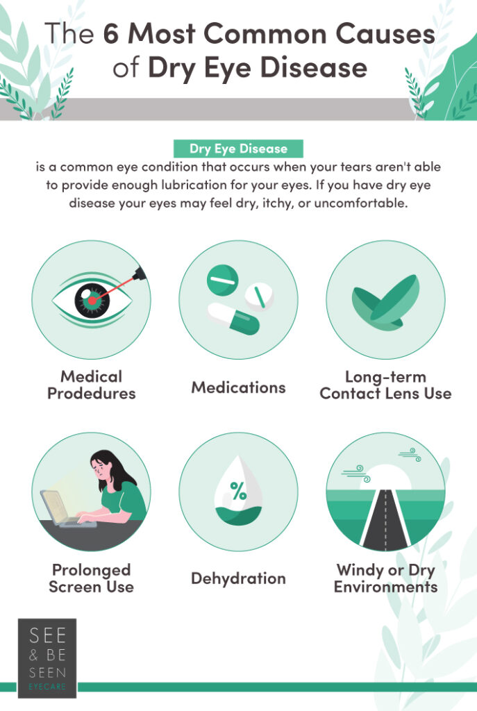 The Causes Of Dry Eyes Toronto See And Be Seen Eyecare 