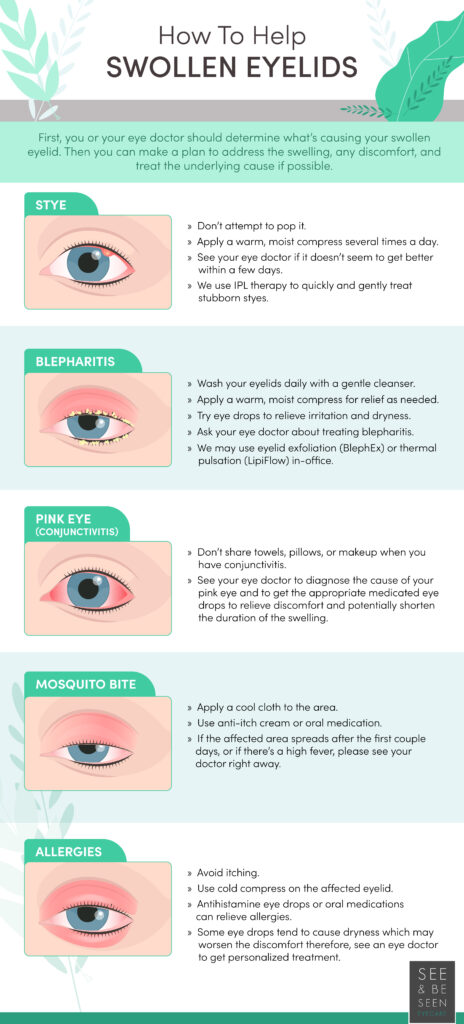 An infographic from See & Be Seen showing ways to get rid of swollen eyelids in case of styes, blepharitis, pink eye and mosquito bites.