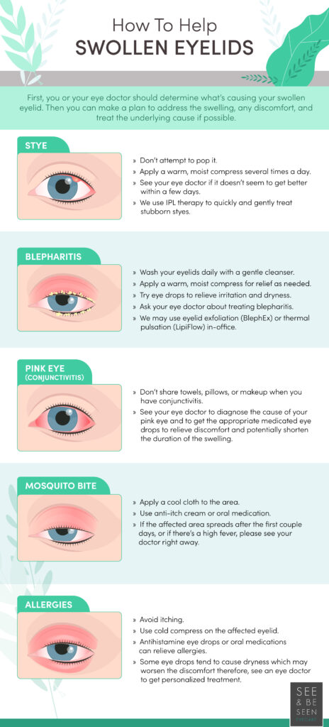 Swollen eyes - Reason and how to prevent them