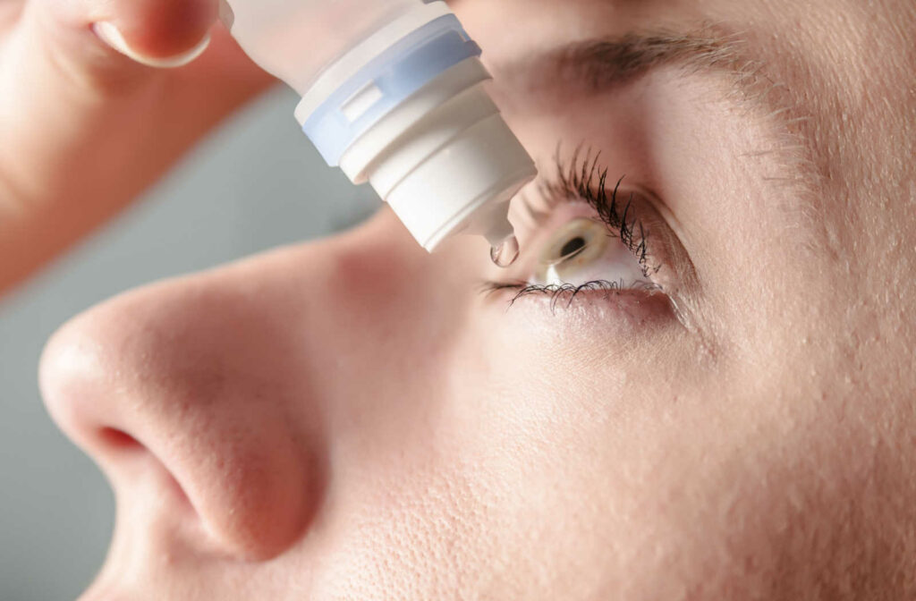 A woman putting eye drops in her eye to add lubrication and moisture to her dry eyes.