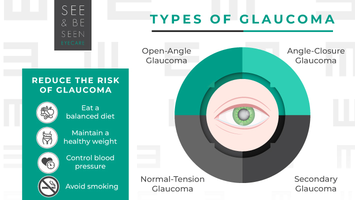 An infographic by See & Be Seen showing the types of glaucoma and tips to reduce the risk