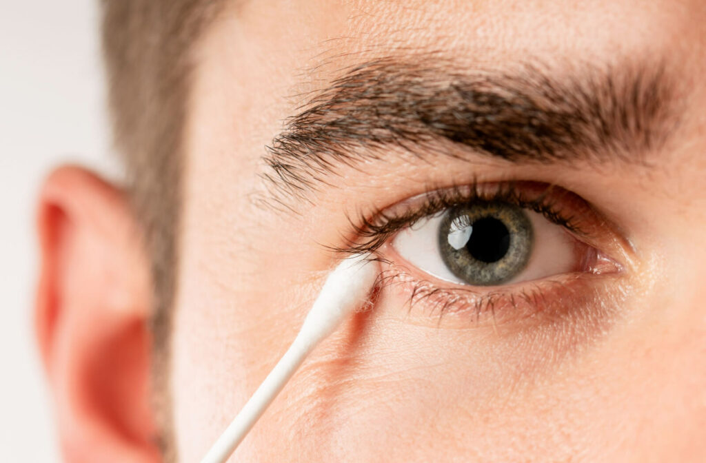 A young adult using a cotton swab to carefully clean the edge of their eyelids.
