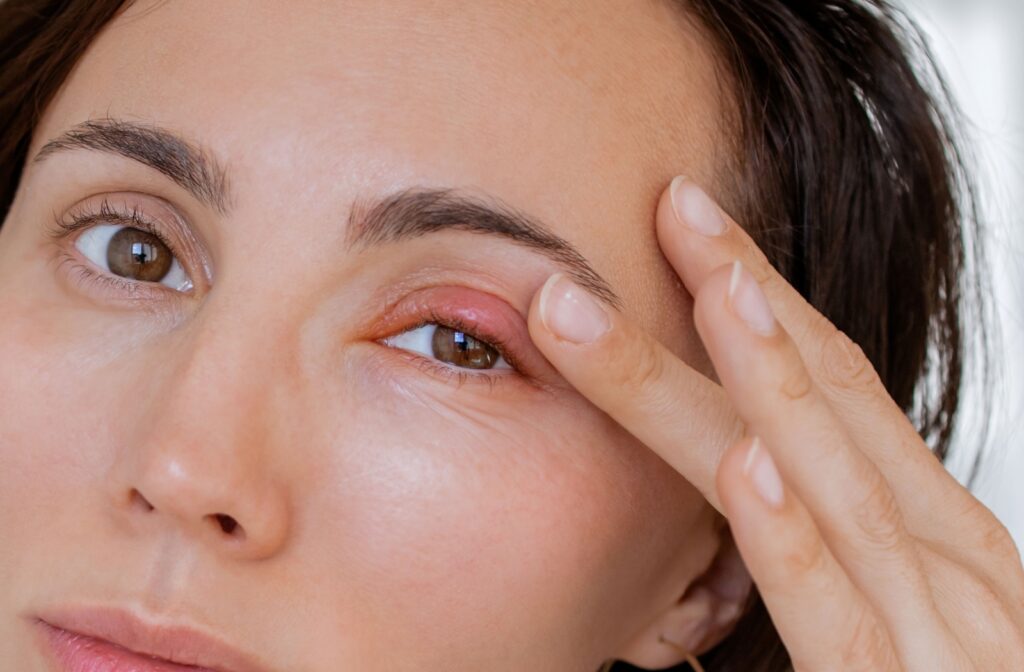 Close-up of a woman touching a red bump on her eyelid, indicating a possible stye.
