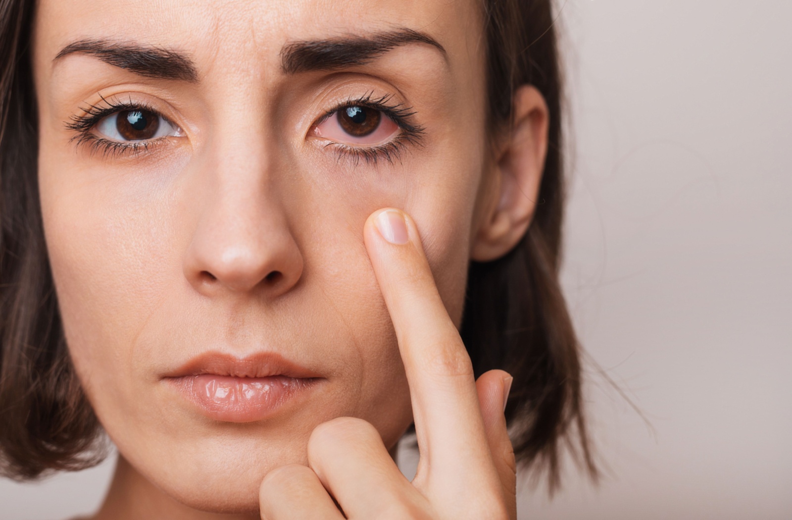 Close-up of a person gently pulling down their lower eyelid to reveal redness, showing possible signs of pink eye.