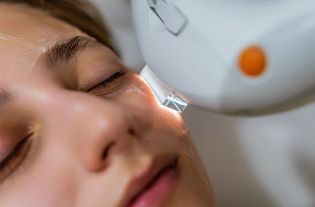 Woman receiving IPL treatment near the eye area to help manage dry eye symptoms.