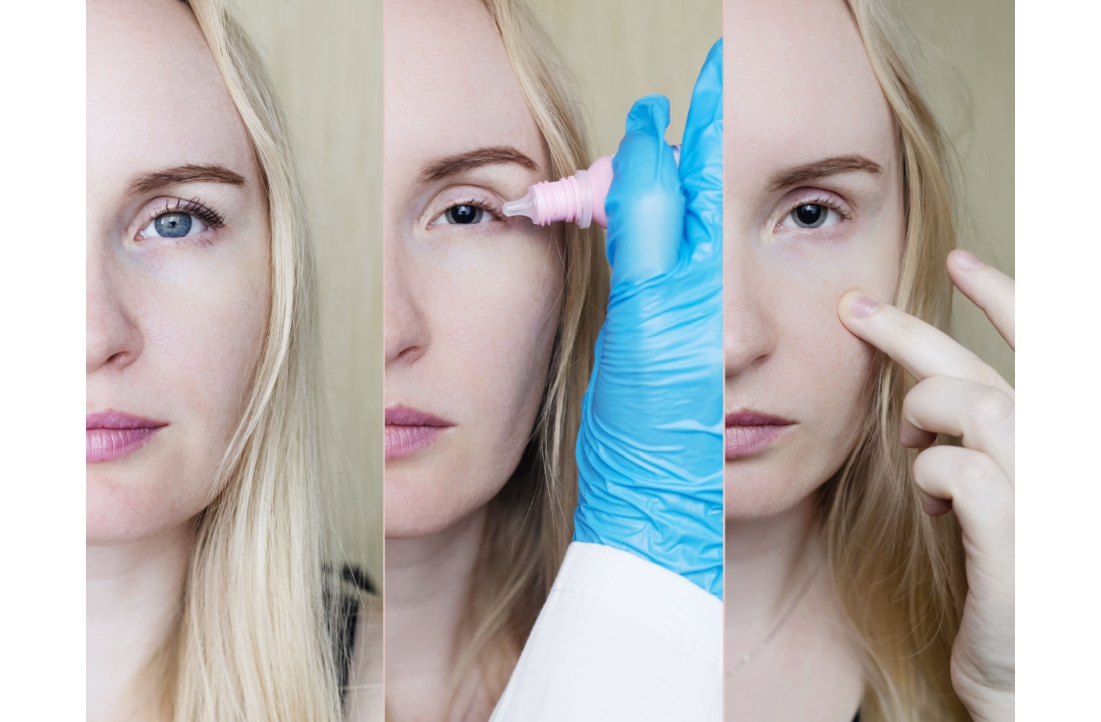 Three-step sequence showing a woman before dilation, receiving eye drops, and after dilation during an eye exam.