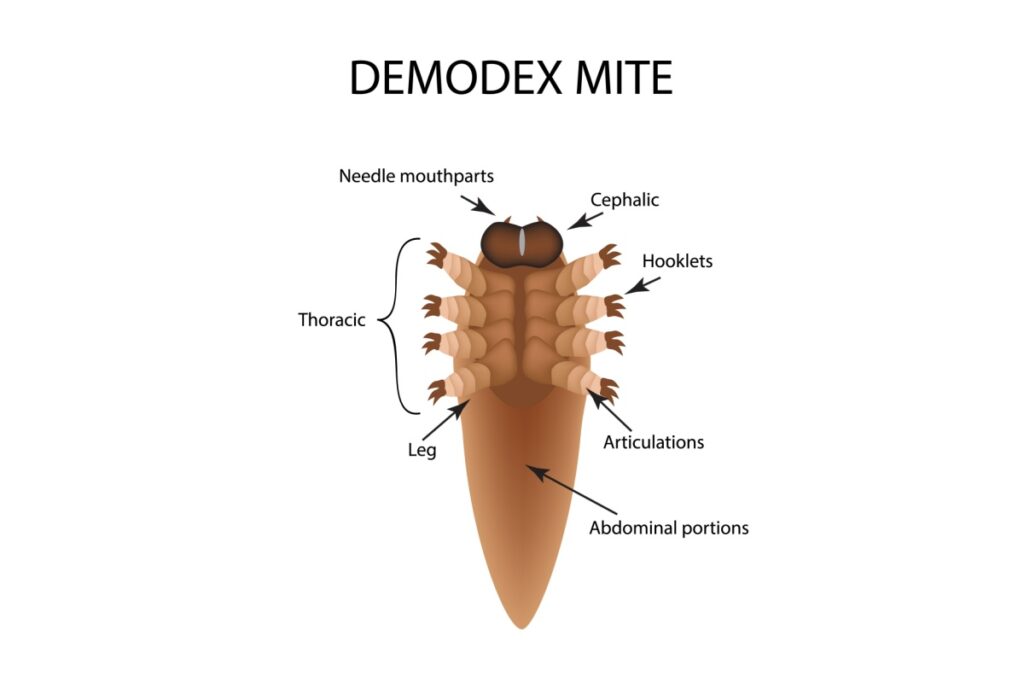 Detailed anatomical diagram of Demodex mite showing labeled body parts including needle mouthparts, cephalic region, hooklets, thoracic section, legs, articulations, and abdominal portions.